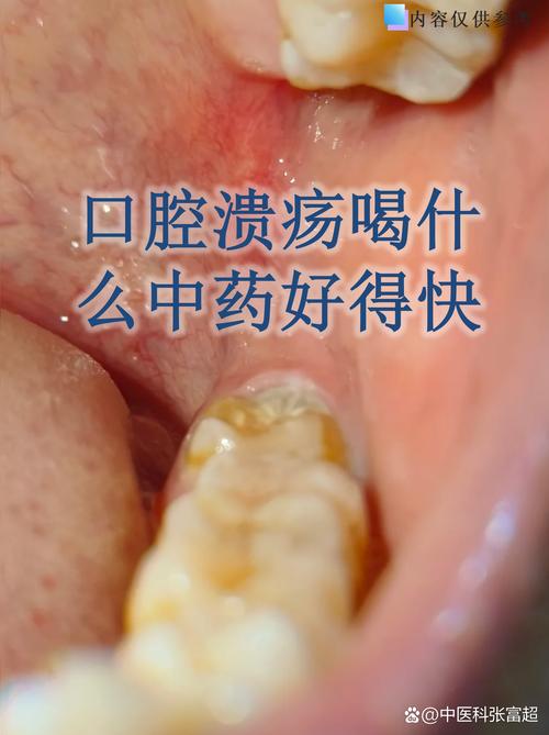 口腔科和药学，哪个更适合你？-图3