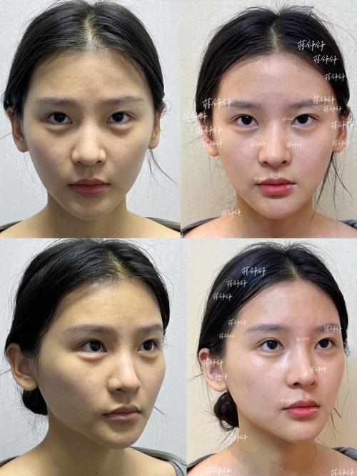 整容的思维，是欲望还是救赎？-图2