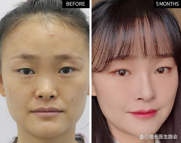 整容的思维，是欲望还是救赎？-图3